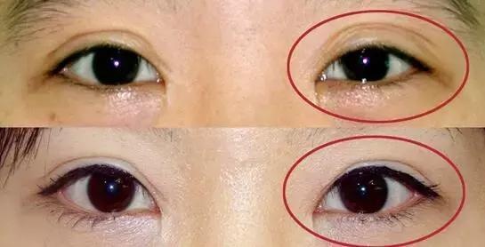 上海最好的修复双眼皮专家排行榜
