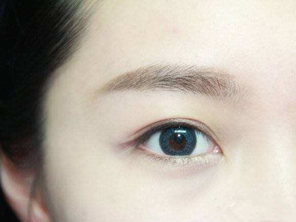 北京著名的双眼皮医生有哪些？