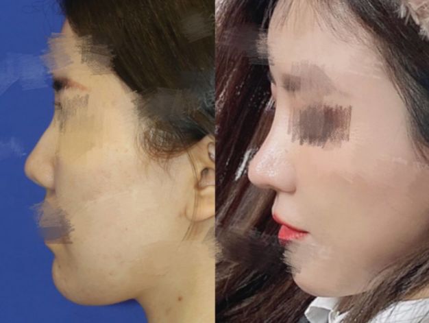 2023年北京最有名的鼻修复专家是谁